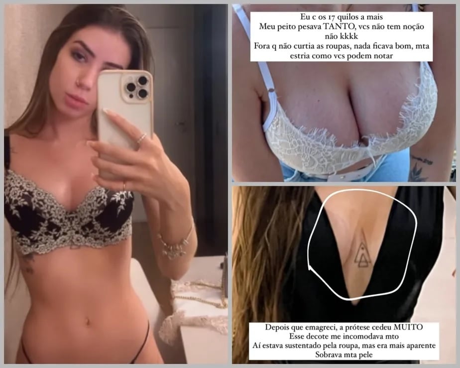 Maria Lina Deggan explica cirurgia nos seios após gravidez de filho de