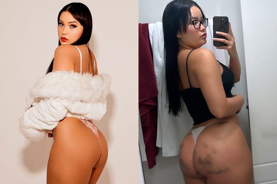 Ex-evangélica que é Musa do OnlyFans turbina bumbum com bioplastia de R$ 40 mil: “montadas ganham mais”